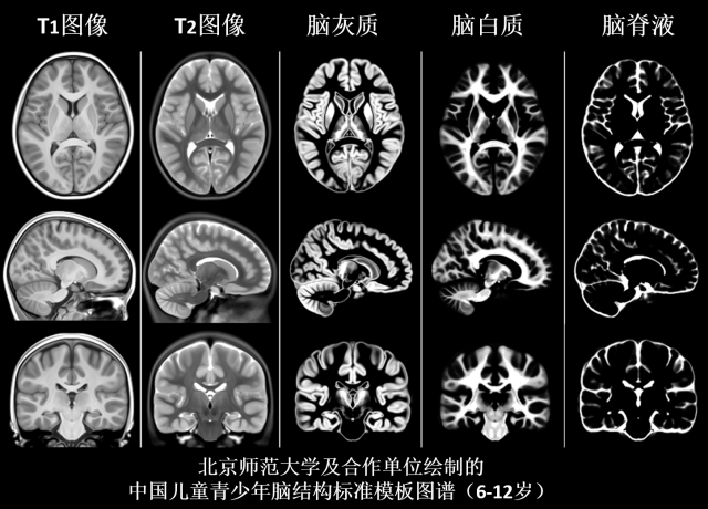 6星空体育（中国）及合作单位绘制的中国儿童青少年脑结构标准模板图谱.png